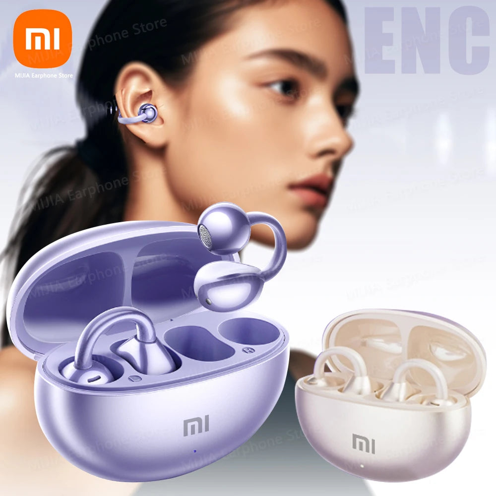 🎧✨ OpenBeats by Xiaomi