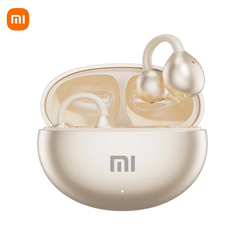 🎧✨ OpenBeats by Xiaomi